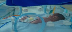 Leia mais sobre o artigo Os desafios da prematuridade e o apoio Legislativo em Roraima