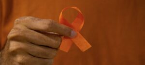 Leia mais sobre o artigo Assembleia Legislativa garante suporte na prevenção ao câncer de pele em RR